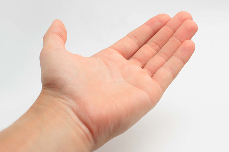 CARPAL TUNNEL SYNDROME