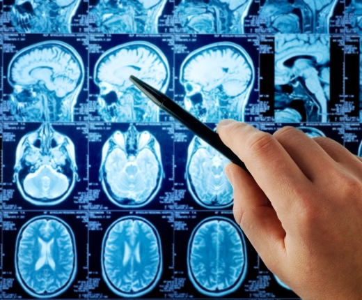MAGNETIC RESONANCE IMAGING-EXAMINATION (MRI)