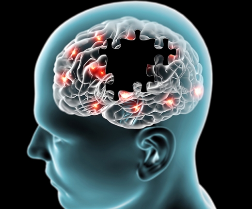 FUNKTIONELLE STÖRUNG