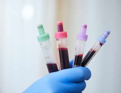 BLOOD TEST