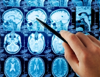 MAGNETIC RESONANCE IMAGING-EXAMINATION (MRI)